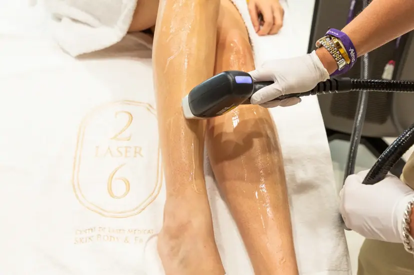 épilation laser sur jambes - Laser 26