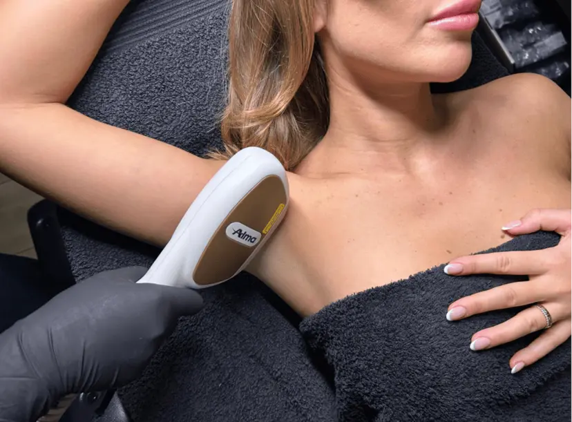 Épilation IPL polychromatique