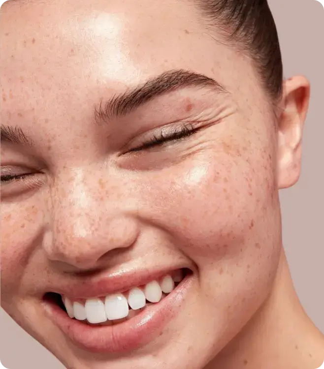 Vignette électrolyse apilus