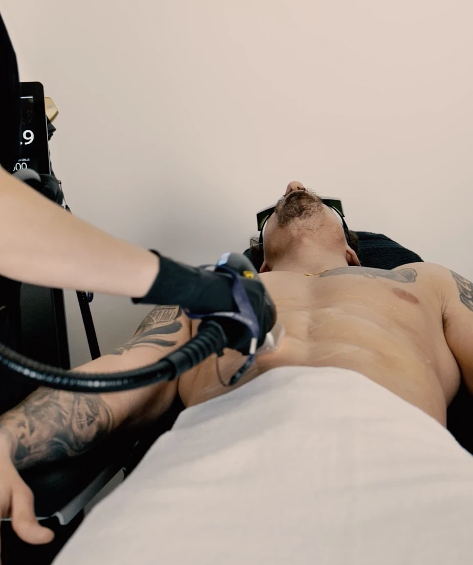 Epilation laser torse homme