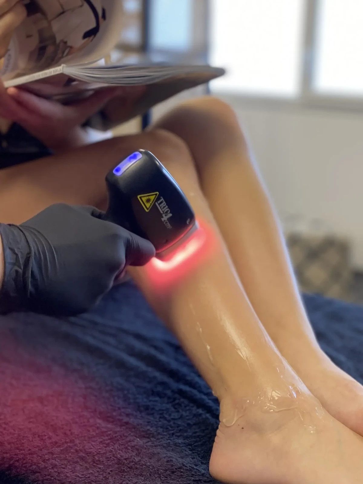 Epilation laser Soprano Titanium sur jambe