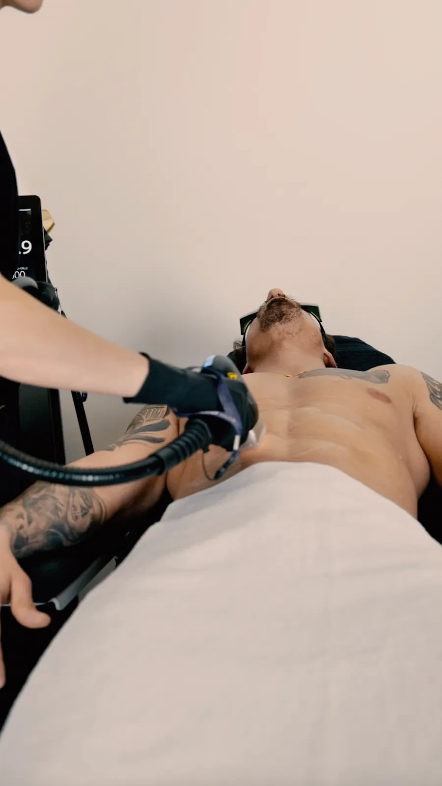 Epilation laser sur un torse d'homme