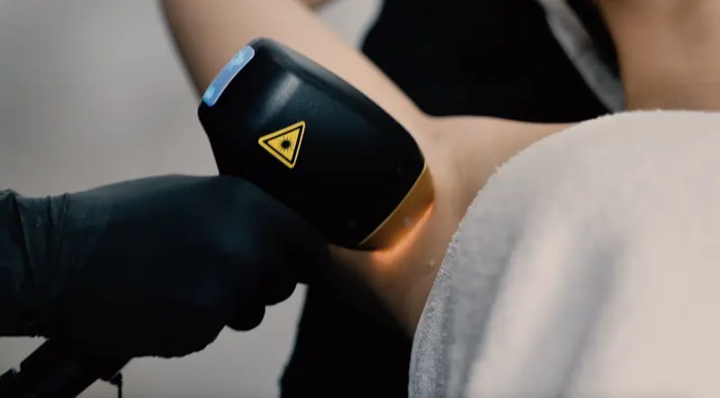 Épilation laser Soprano Titanium