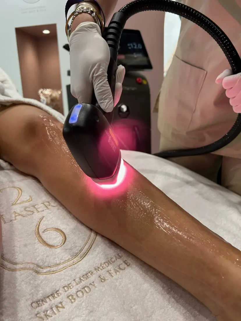 Epilation définitive Candela Gentlemax Pro Plus - laser 26