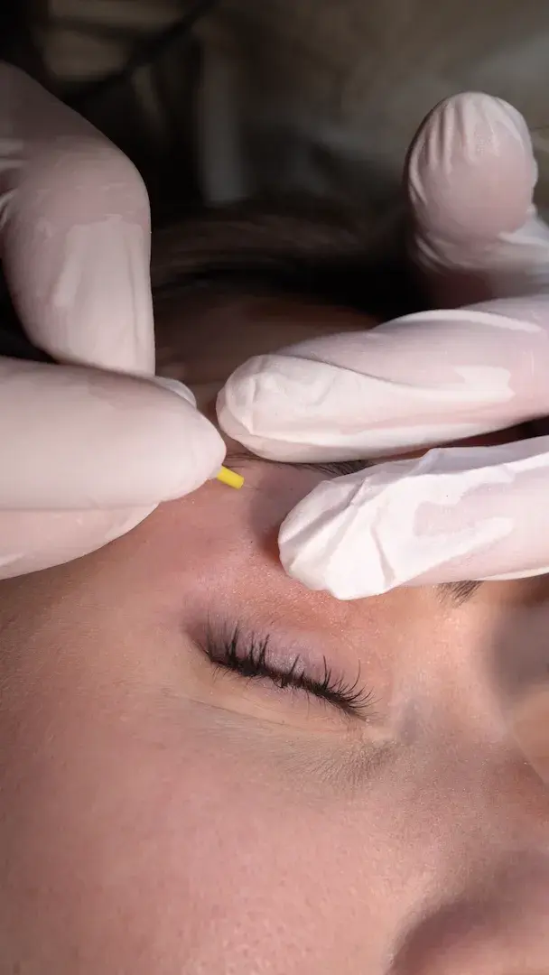 Épilation des sourcils